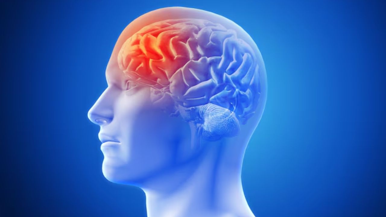 brain stroke
