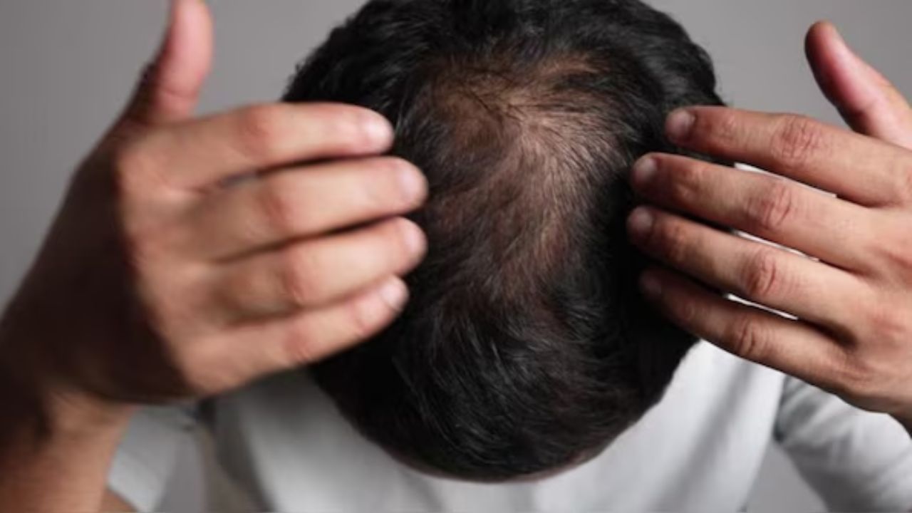 Buldhana Hair and Nail loss