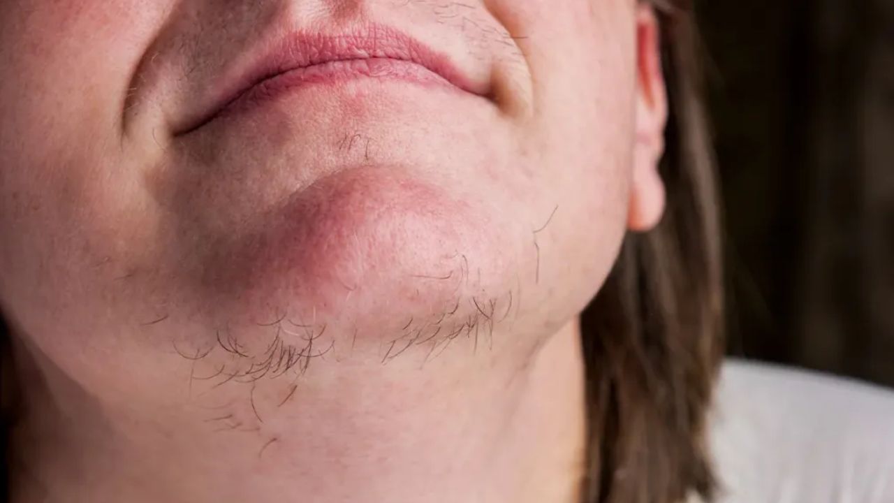 Facial Hair