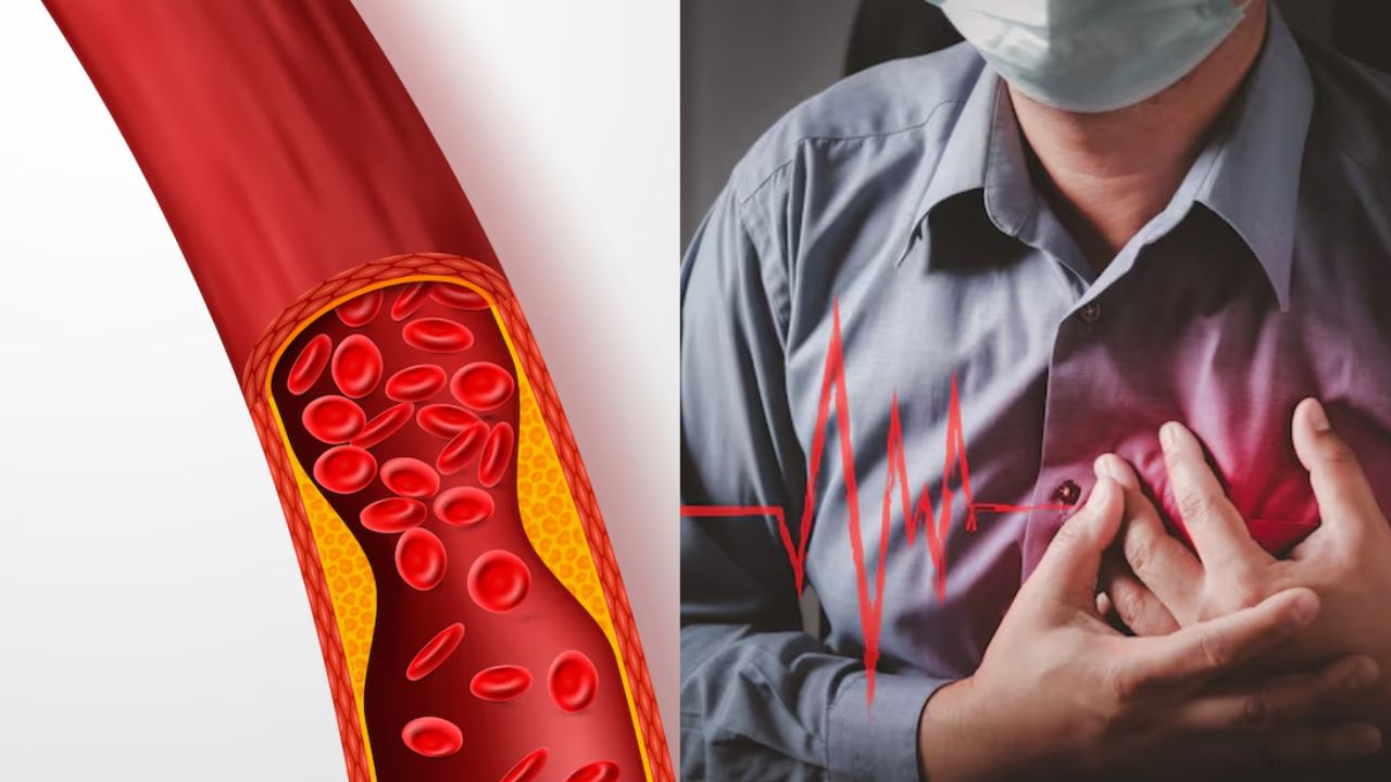 high Cholesterol increase heart attack