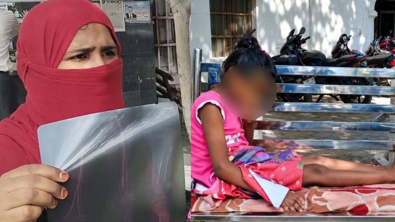 Muzaffarnagar doctor repair bone but broke it again