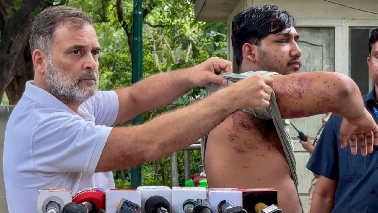 man injured with pallet gun