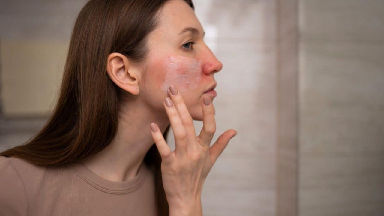 skin problem rainy season