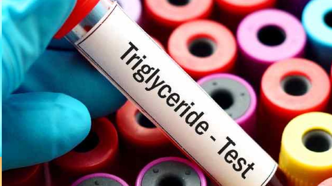 triglycerides