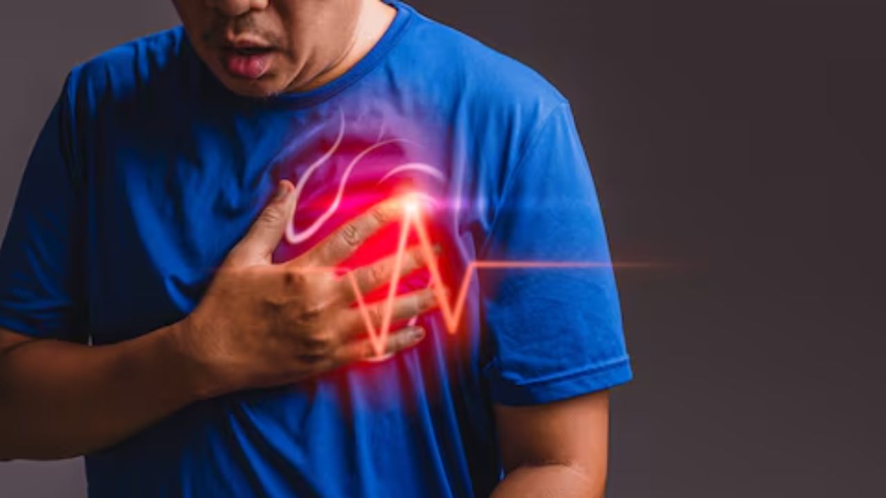 Representational Picture